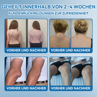 Als treuer Kunde gewähren wir Ihnen einen exklusiven Rabatt von 50%🦴𝖯𝗂𝖼𝗱𝗼® BPC-157 Gelenkheilcreme