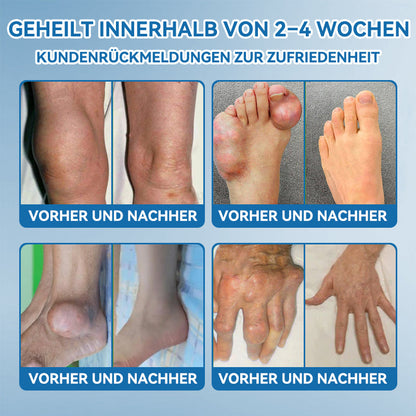 Als treuer Kunde gewähren wir Ihnen einen exklusiven Rabatt von 50%🦴𝖯𝗂𝖼𝗱𝗼® BPC-157 Gelenkheilcreme