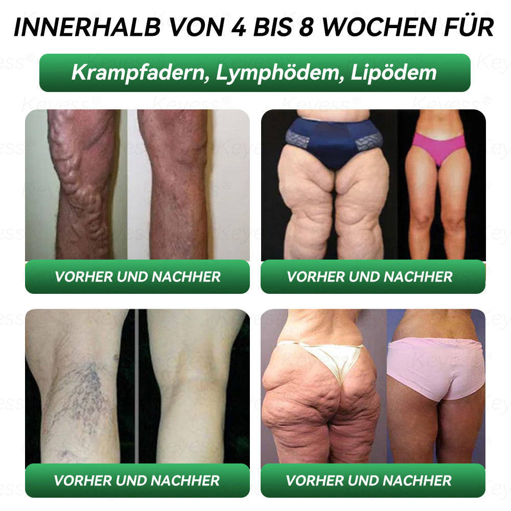 𝗞𝗲𝘆𝗲𝘀𝘀®🎁 Herzlichen Glückwunsch! Sie sind einer unserer glücklichen Gewinner! 💪 Als unser exklusiver Glücksstern erhalten Sie jetzt unglaubliche 50% Rabatt! Verpassen Sie nicht diese einmalige Gelegenheit, sich etwas Besonderes zu gönnen!