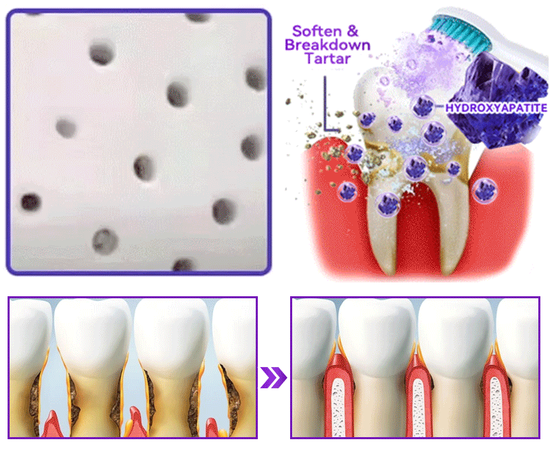 𝑫𝑜𝑟𝒎𝒐𝒓𝙣𝙖® 𝐻𝑦𝑑𝑟𝑜𝑥𝑦𝑙𝑎𝑝𝑎𝑡𝑖𝑡  𝑍𝑎ℎ𝑛𝑟𝑒𝑝𝑎𝑟𝑎𝑡𝑢𝑟𝑝𝑢𝑙𝑣𝑒𝑟🦷Behandlung von Zahnkaries, Parodontitis, Zahnempfindlichkeit und Mundkrebs🏆