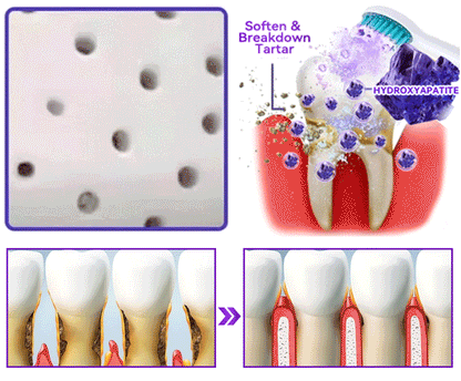 𝑫𝑜𝑟𝒎𝒐𝒓𝙣𝙖® 𝐻𝑦𝑑𝑟𝑜𝑥𝑦𝑙𝑎𝑝𝑎𝑡𝑖𝑡  𝑍𝑎ℎ𝑛𝑟𝑒𝑝𝑎𝑟𝑎𝑡𝑢𝑟𝑝𝑢𝑙𝑣𝑒𝑟🦷Behandlung von Zahnkaries, Parodontitis, Zahnempfindlichkeit und Mundkrebs🏆