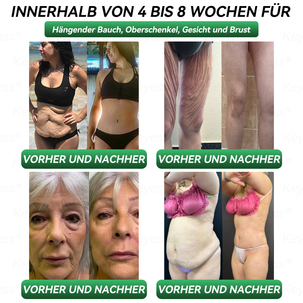 𝗞𝗲𝘆𝗲𝘀𝘀®🎁 Herzlichen Glückwunsch! Sie sind einer unserer glücklichen Gewinner! 💪 Als unser exklusiver Glücksstern erhalten Sie jetzt unglaubliche 50% Rabatt! Verpassen Sie nicht diese einmalige Gelegenheit, sich etwas Besonderes zu gönnen!