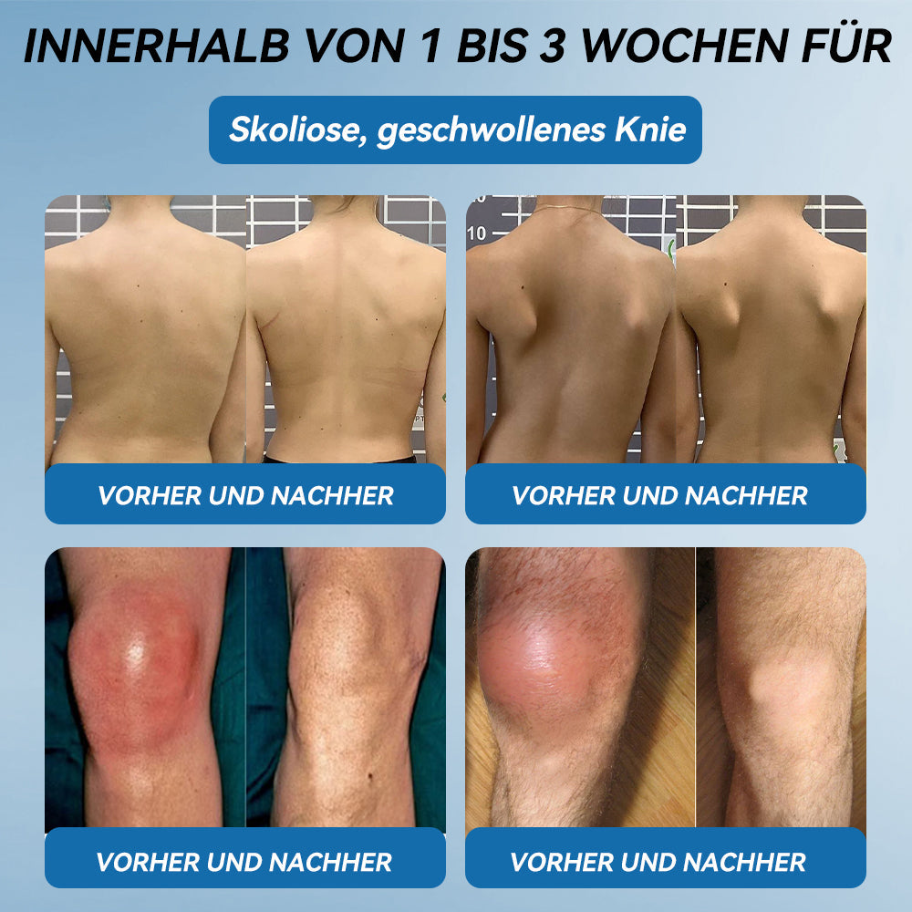 Als treuer Kunde gewähren wir Ihnen einen exklusiven Rabatt von 50%🦴𝖯𝗂𝖼𝗱𝗼® BPC-157 Gelenkheilcreme