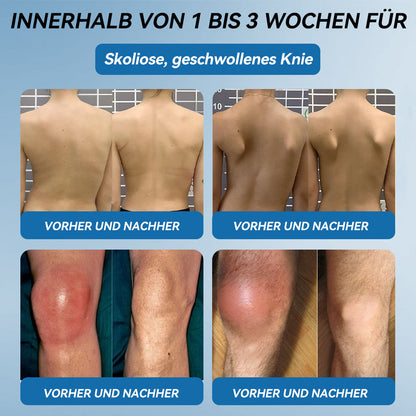 Als treuer Kunde gewähren wir Ihnen einen exklusiven Rabatt von 50%🦴𝖯𝗂𝖼𝗱𝗼® BPC-157 Gelenkheilcreme