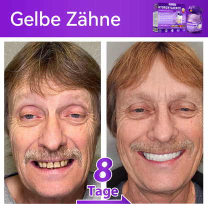 𝑫𝑜𝑟𝒎𝒐𝒓𝙣𝙖® 𝐻𝑦𝑑𝑟𝑜𝑥𝑦𝑙𝑎𝑝𝑎𝑡𝑖𝑡  𝑍𝑎ℎ𝑛𝑟𝑒𝑝𝑎𝑟𝑎𝑡𝑢𝑟𝑝𝑢𝑙𝑣𝑒𝑟🦷Behandlung von Zahnkaries, Parodontitis, Zahnempfindlichkeit und Mundkrebs🏆