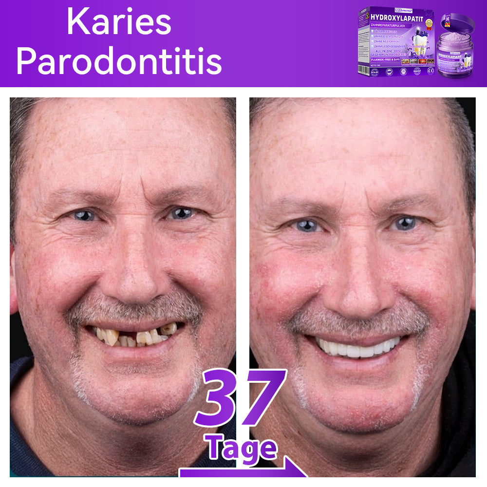 𝑫𝑜𝑟𝒎𝒐𝒓𝙣𝙖® 𝐻𝑦𝑑𝑟𝑜𝑥𝑦𝑙𝑎𝑝𝑎𝑡𝑖𝑡  𝑍𝑎ℎ𝑛𝑟𝑒𝑝𝑎𝑟𝑎𝑡𝑢𝑟𝑝𝑢𝑙𝑣𝑒𝑟🦷Behandlung von Zahnkaries, Parodontitis, Zahnempfindlichkeit und Mundkrebs🏆