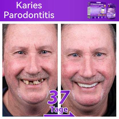 𝑫𝑜𝑟𝒎𝒐𝒓𝙣𝙖® 𝐻𝑦𝑑𝑟𝑜𝑥𝑦𝑙𝑎𝑝𝑎𝑡𝑖𝑡  𝑍𝑎ℎ𝑛𝑟𝑒𝑝𝑎𝑟𝑎𝑡𝑢𝑟𝑝𝑢𝑙𝑣𝑒𝑟🦷Behandlung von Zahnkaries, Parodontitis, Zahnempfindlichkeit und Mundkrebs🏆