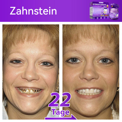 𝑫𝑜𝑟𝒎𝒐𝒓𝙣𝙖® 𝐻𝑦𝑑𝑟𝑜𝑥𝑦𝑙𝑎𝑝𝑎𝑡𝑖𝑡  𝑍𝑎ℎ𝑛𝑟𝑒𝑝𝑎𝑟𝑎𝑡𝑢𝑟𝑝𝑢𝑙𝑣𝑒𝑟🦷Behandlung von Zahnkaries, Parodontitis, Zahnempfindlichkeit und Mundkrebs🏆