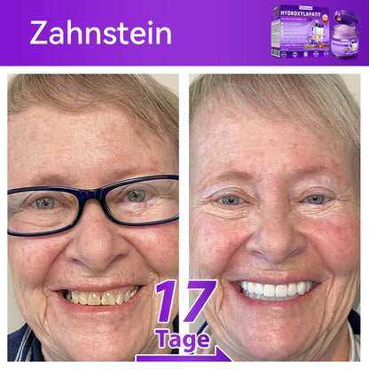 𝑫𝑜𝑟𝒎𝒐𝒓𝙣𝙖® 𝐻𝑦𝑑𝑟𝑜𝑥𝑦𝑙𝑎𝑝𝑎𝑡𝑖𝑡  𝑍𝑎ℎ𝑛𝑟𝑒𝑝𝑎𝑟𝑎𝑡𝑢𝑟𝑝𝑢𝑙𝑣𝑒𝑟🦷Behandlung von Zahnkaries, Parodontitis, Zahnempfindlichkeit und Mundkrebs🏆